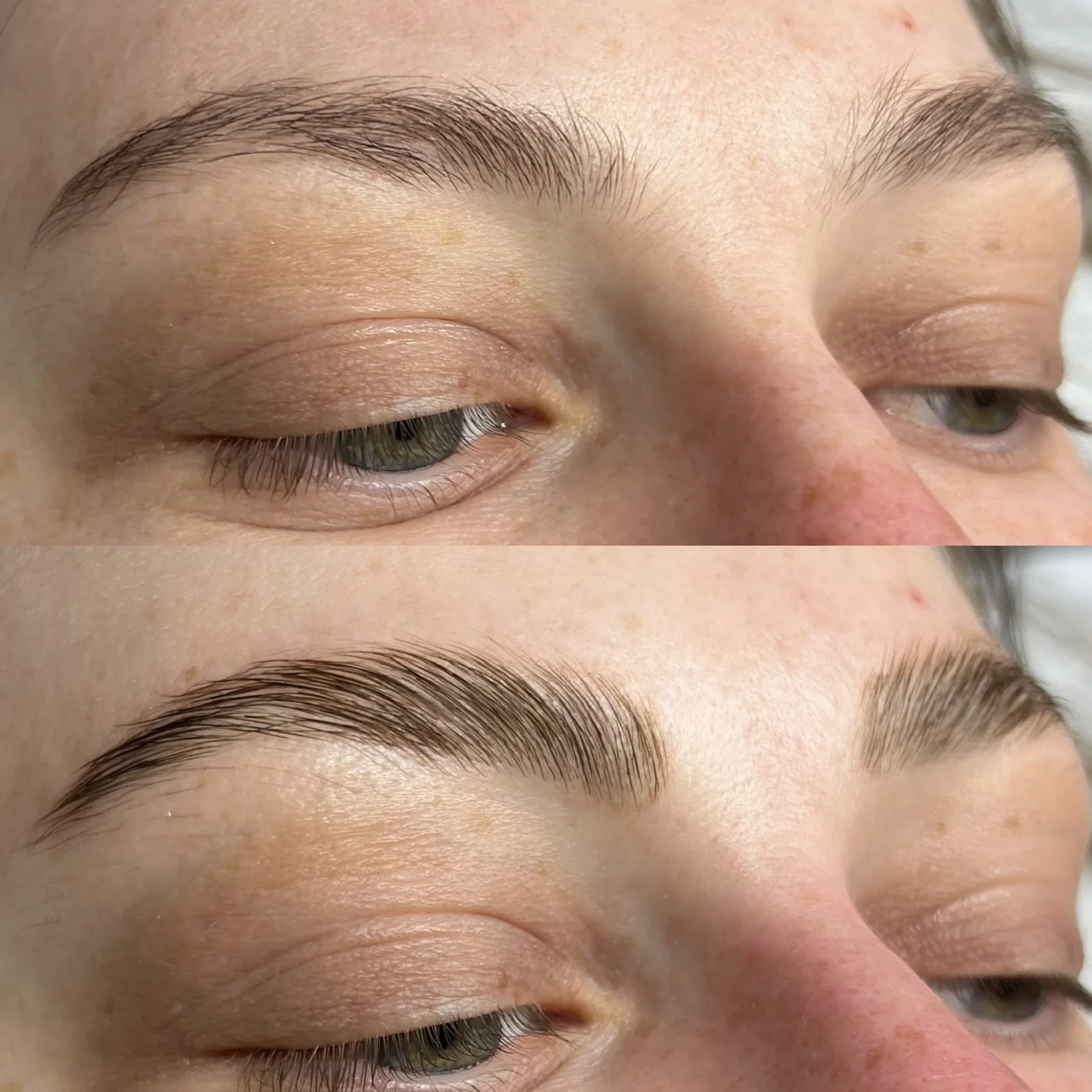 Browlifting Ergebnis — Vorher und Nachher