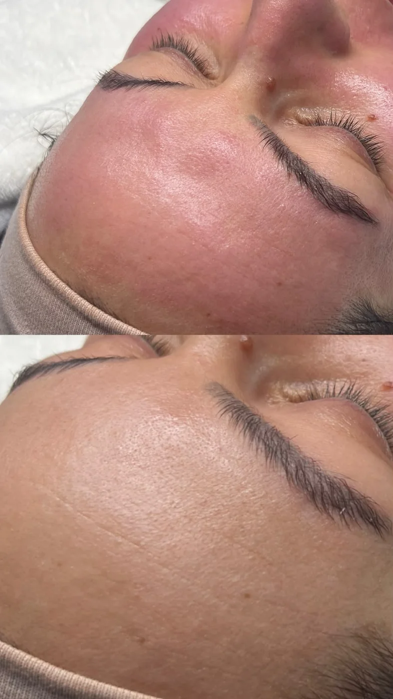 Gold Skin Ergebnis — Vorher und Nachher