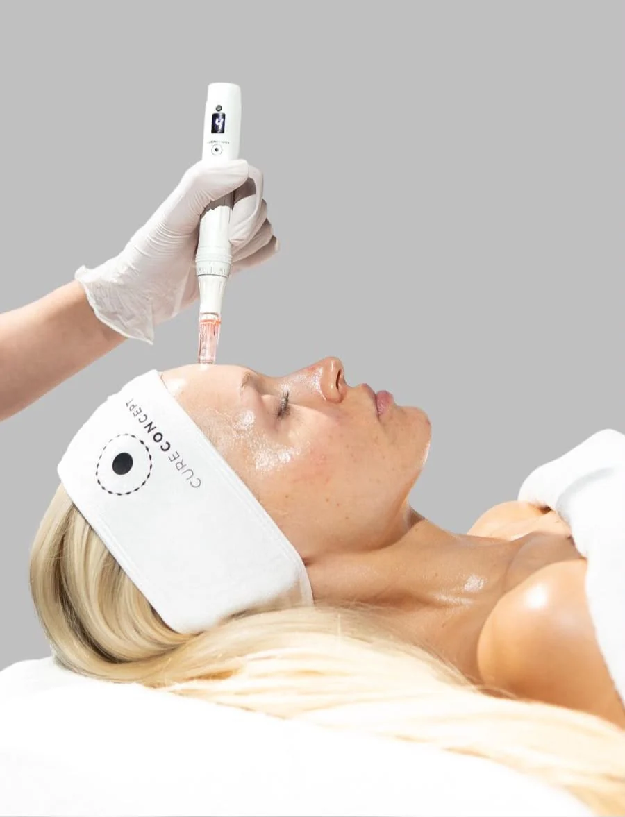 Lachs-DNA-Microneedling