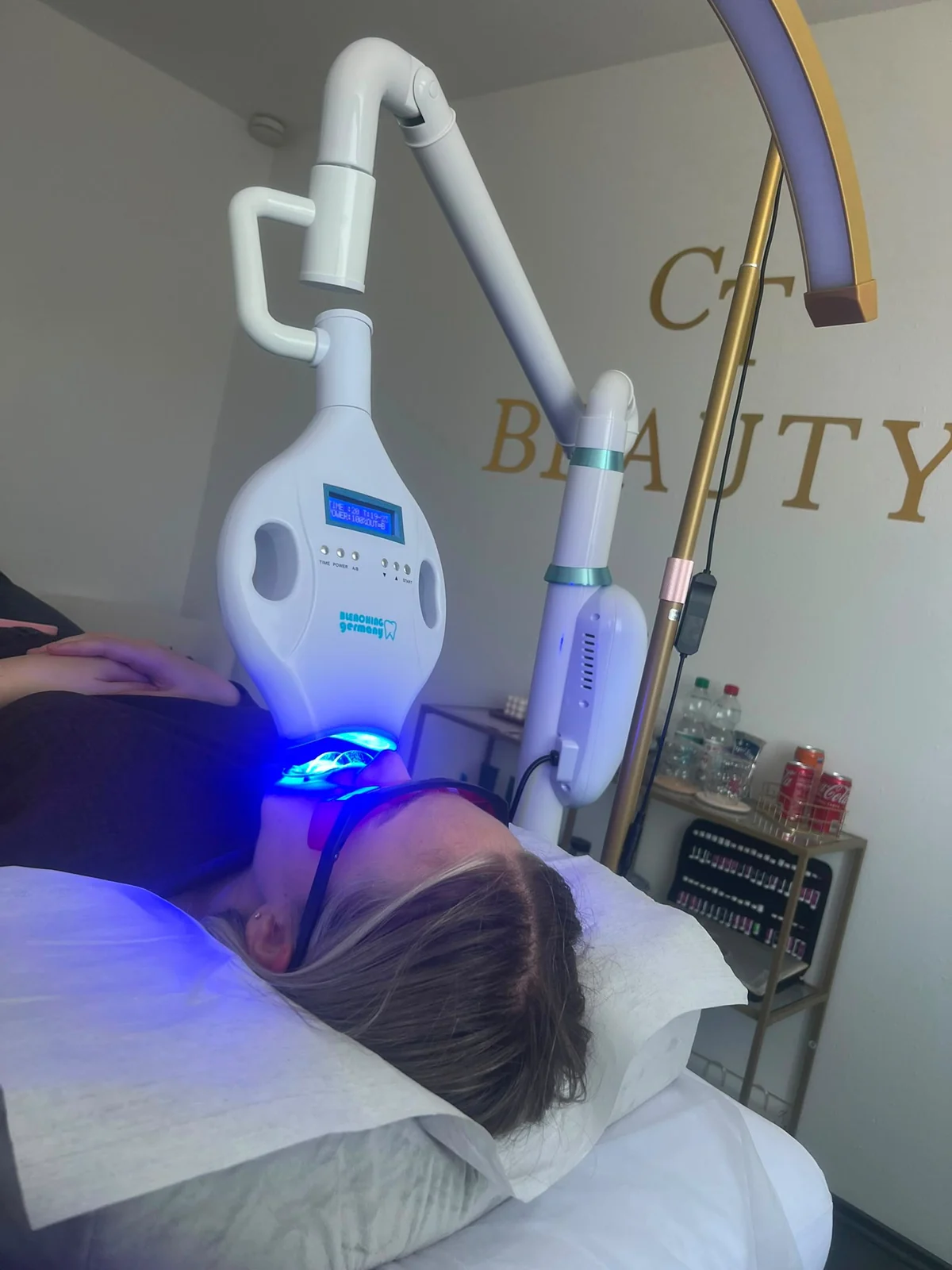 Zahnbleaching Behandlung mit Bleaching-Gerät