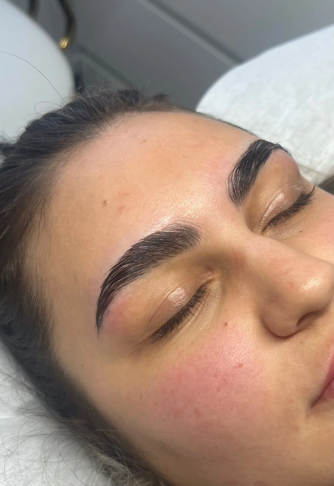 Browlifting Ergebnis