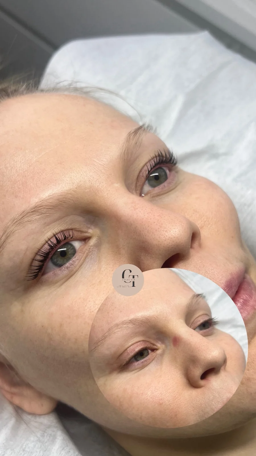 Lashlifting